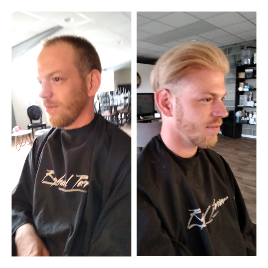 Traitement contre la chute de cheveux