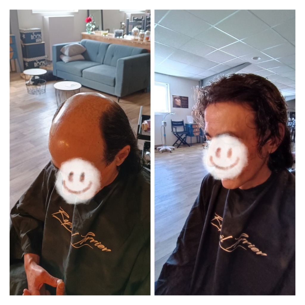 Résultat avant et après d'une pose de complément capillaire homme
